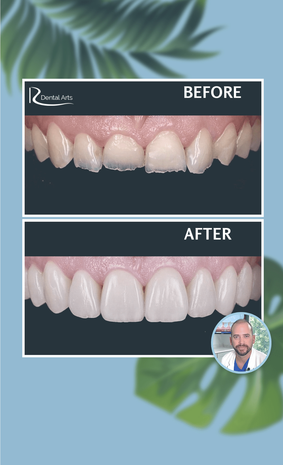 Tips for Finding the Best Dentist in Riverview, FL